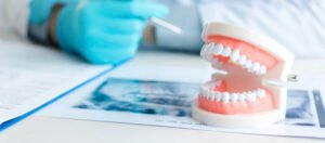Permanent dentures Los Angels