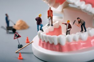Fix All teeth