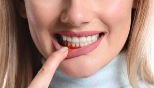 gum disease treatment