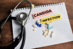 Candida and Oral Thrush