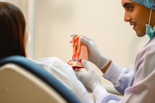 root canals
