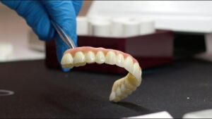 ceramic crowns