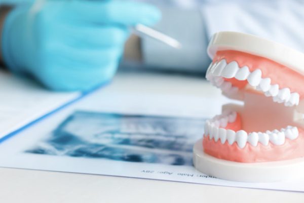 Permanent dentures Los Angels