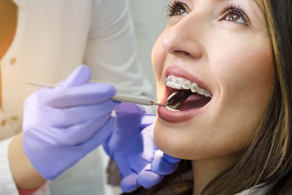 braces cost with insurance