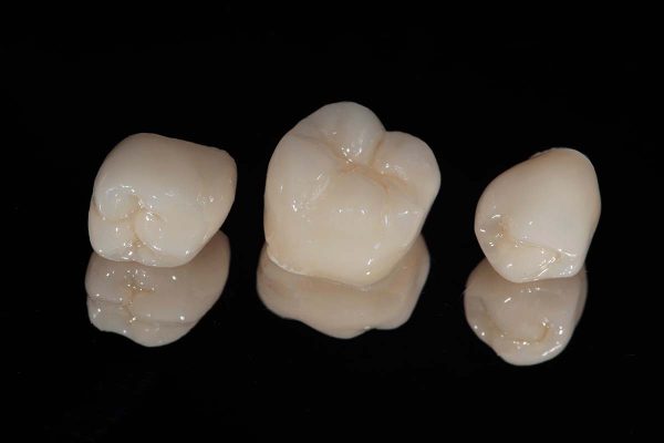 dental crown for kids