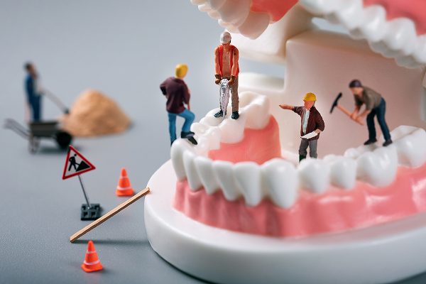 Fix All teeth