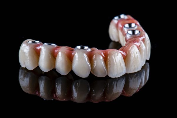 full mouth dental implants Los Angeles