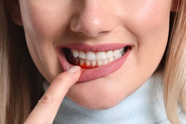 gum disease treatment