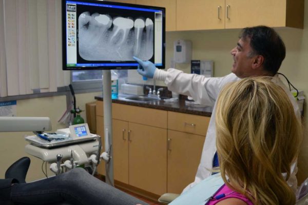 root canal specialist beverly hills