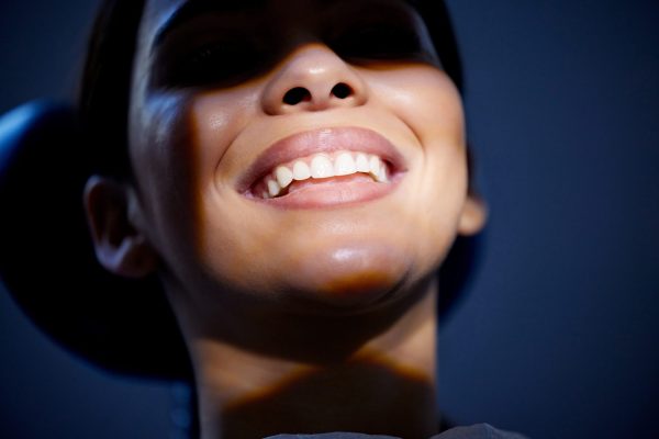 Full Arch Restoration vs. Dentures in Beverly Hills