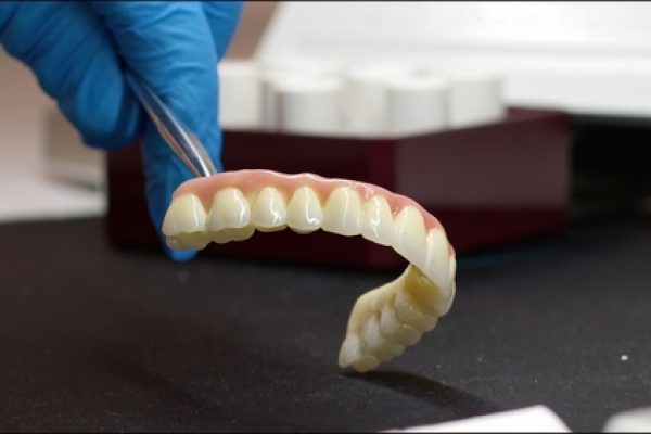 ceramic crowns