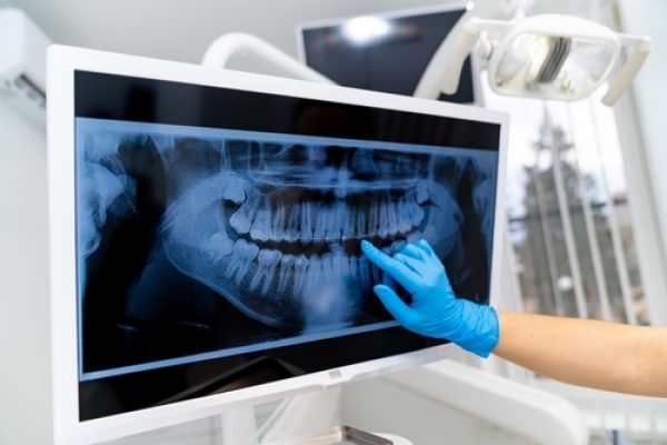digital dental