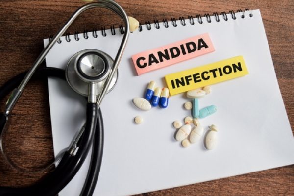 Candida and Oral Thrush