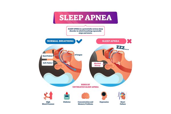 importance of sleep apnea treatment