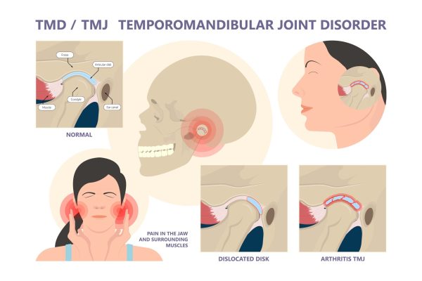 tmj-los-angeles